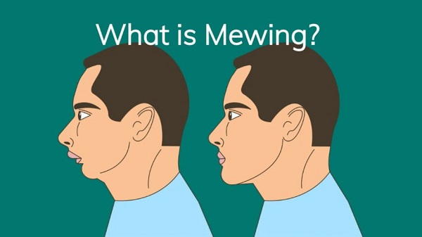 Mewing có thực sự hiệu quả?