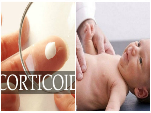 Trẻ có thể bị ngộ độc toàn thân nếu dùng thuốc bôi ngoài da có thành phần corticoid